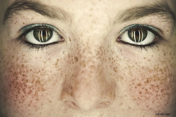 15 Stunning Freckle Portraits: Captivating Photo Collection [Updated]
