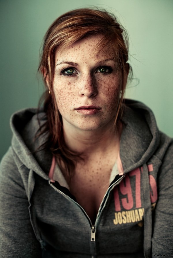 15 Stunning Freckle Portraits: Captivating Photo Collection [Updated]