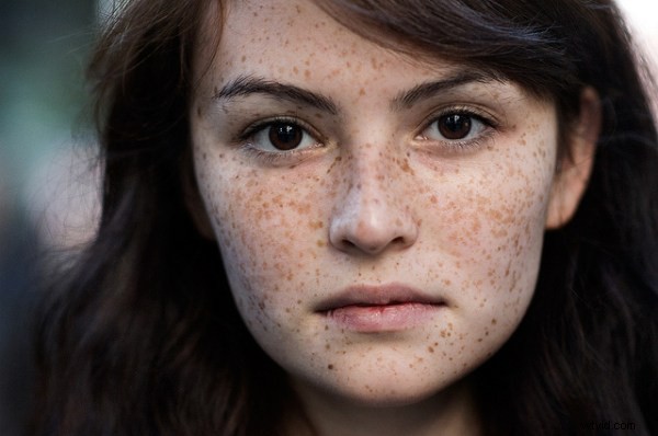 15 Stunning Freckle Portraits: Captivating Photo Collection [Updated]