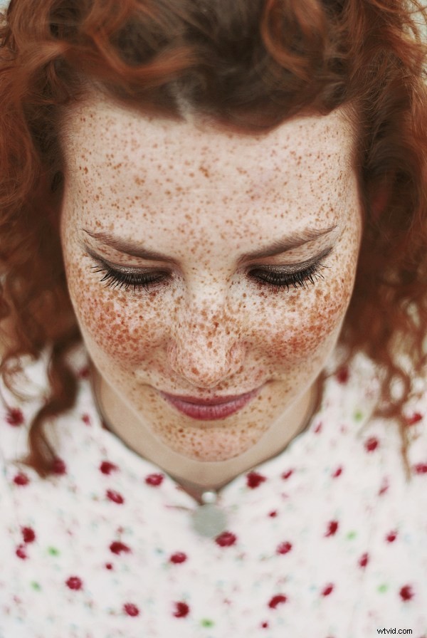15 Stunning Freckle Portraits: Captivating Photo Collection [Updated]