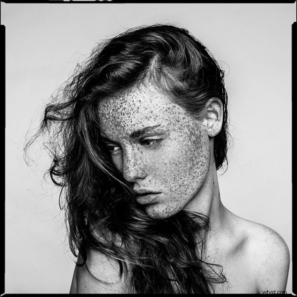 15 Stunning Freckle Portraits: Captivating Photo Collection [Updated]