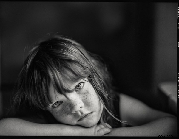 15 Stunning Freckle Portraits: Captivating Photo Collection [Updated]