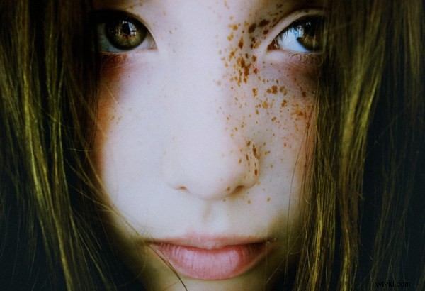 15 Stunning Freckle Portraits: Captivating Photo Collection [Updated]