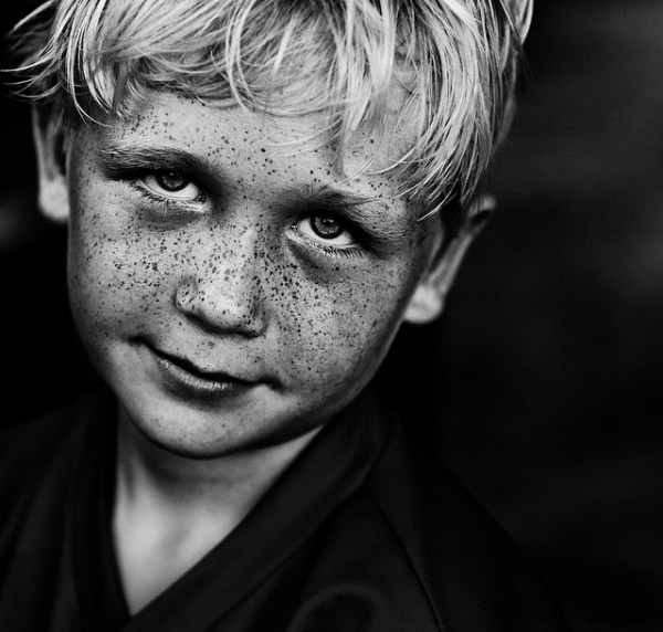 15 Stunning Freckle Portraits: Captivating Photo Collection [Updated]
