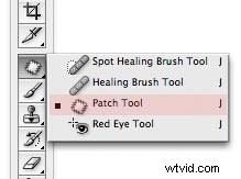 Effortlessly Erase Dark Circles Under Eyes in Photoshop: Pro Technique