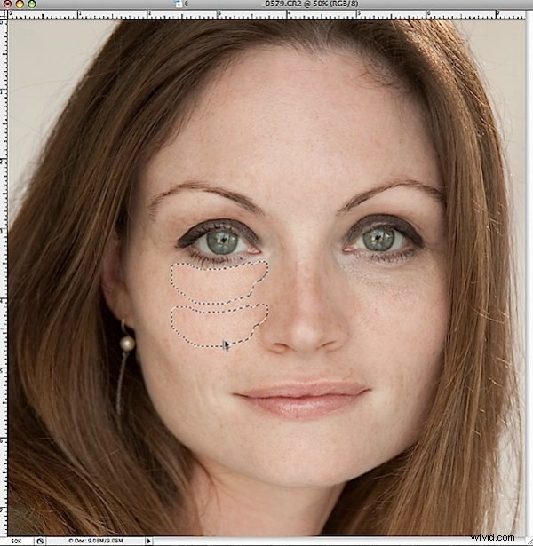 Effortlessly Erase Dark Circles Under Eyes in Photoshop: Pro Technique