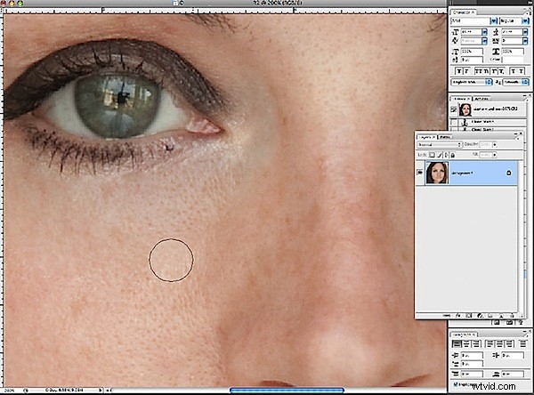 Effortlessly Erase Dark Circles Under Eyes in Photoshop: Pro Technique