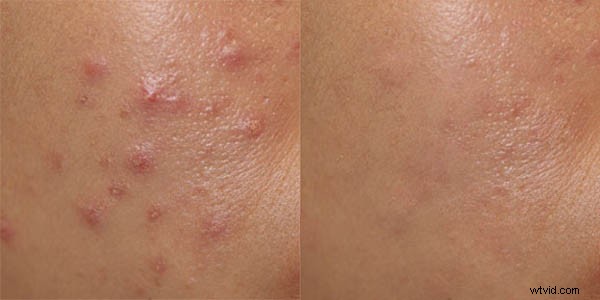 Master 6 Confused Photoshop Tools: Fill vs Opacity, Healing Brush vs Clone Stamp, Merge Visible vs Flatten