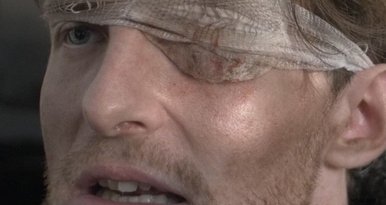 Eliminate Unwanted Skin Shine in Post-Production: DaVinci Resolve Guide for Filmmakers