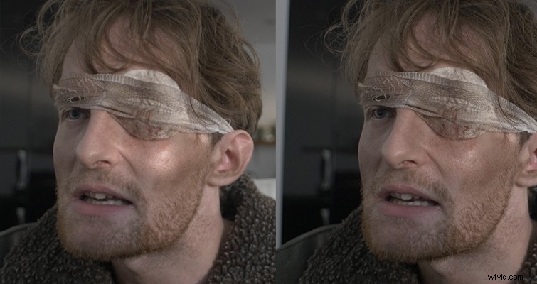 Eliminate Unwanted Skin Shine in Post-Production: DaVinci Resolve Guide for Filmmakers