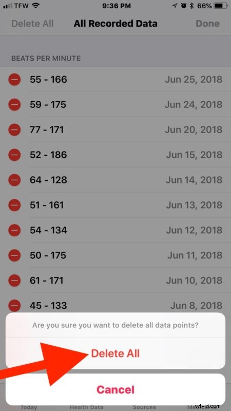 Step-by-Step Guide: Delete Health App Data on iPhone (iOS 12 & Earlier)