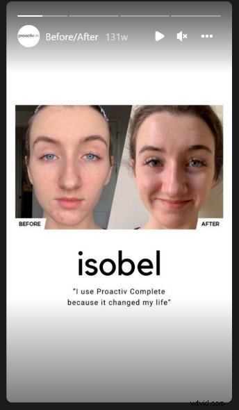 19 Proven Instagram Story Ideas & Best Practices to Boost Followers and Business Growth