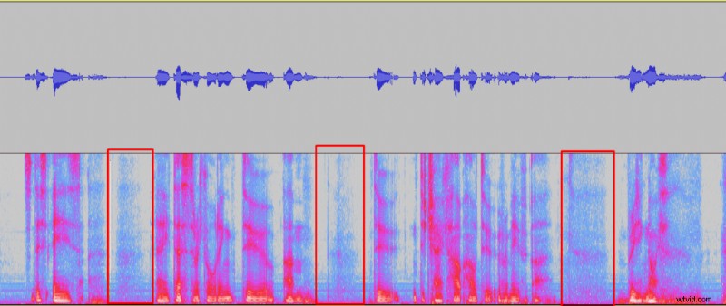 Effortlessly Remove Breathing Noise in Audacity: Step-by-Step Guide